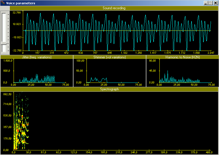 Voice Parameters